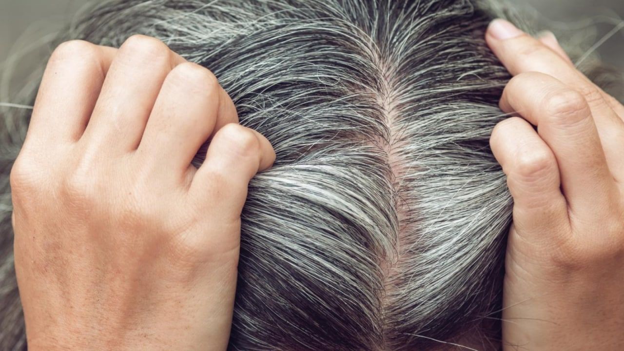 От чего могут появится седые волосы в 17 лет